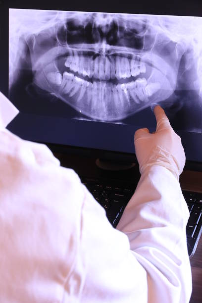 Best Emergency Dentist for Knocked-Out Tooth in Aberdeen, NC