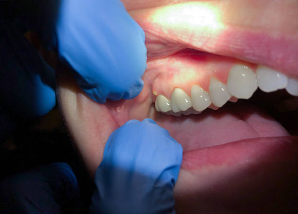 Best Pediatric Emergency Dentist in Aberdeen, NC