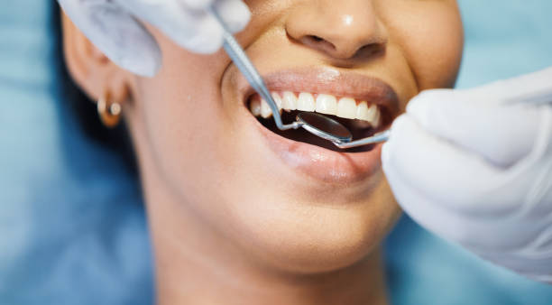 Best Emergency Root Canal Treatment in Aberdeen, NC