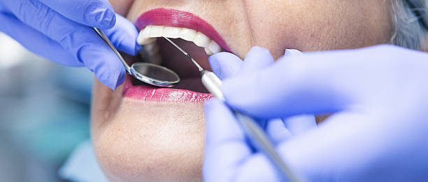 Best Emergency Dentist for Lost Fillings or Crowns in Aberdeen, NC